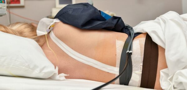 Epiduralna anestezija i druge vrste anestezija na porodjaju