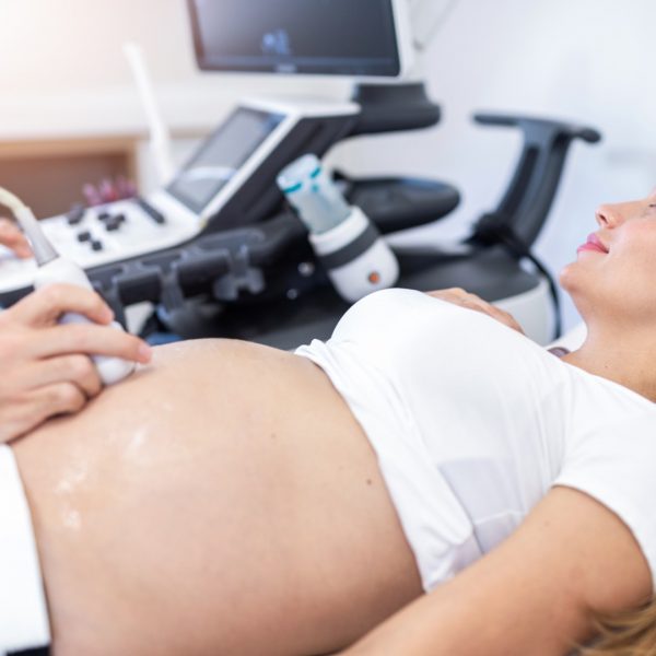 4D i 5D ultrazvucni pregled trudnice