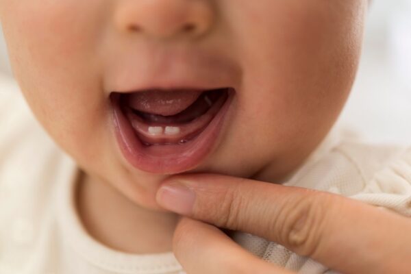 Bebi niču zubi