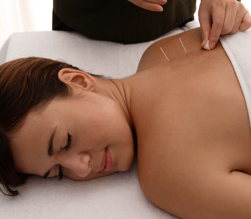 akupunktura i zdravlje žene (2)