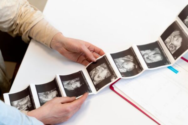 Tumacenje UZ nalaza do 4. meseca trudnocće