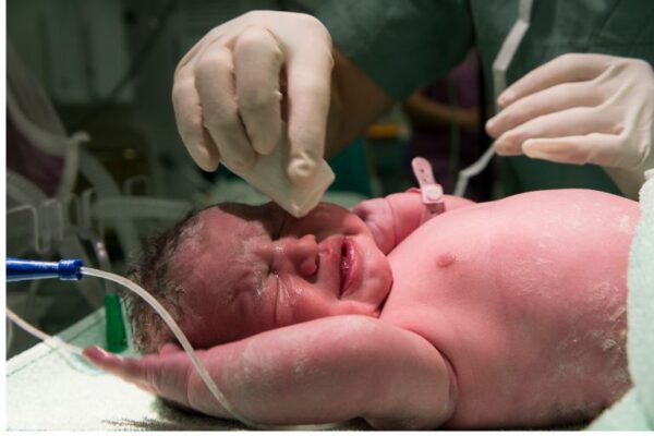 Promene na koži novorođenčeta