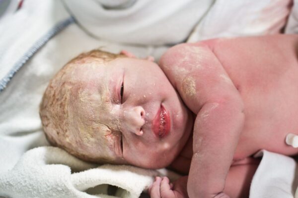 Promene na koži novorođenčeta