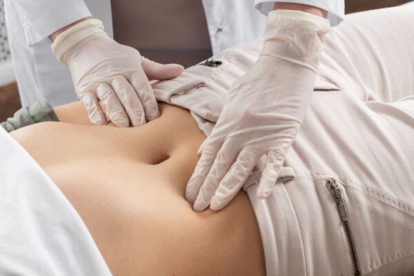 Dijastaza trbušnih mišića