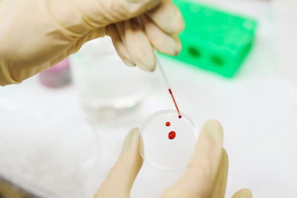 HELLP sindrom kod trudnica