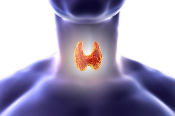 Hasimoto tireoiditis 